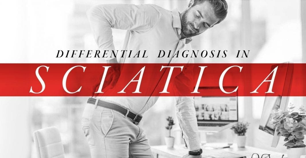 Differential Diagnosis in Sciatica Part 1 | El Paso, TX Chiropractor