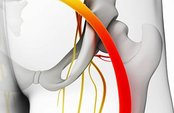 Integrative Sciatica Pain Relief Through Chiropractic Care
