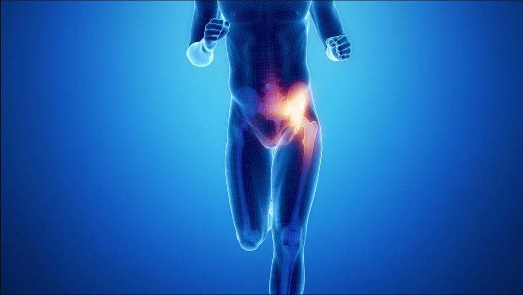 Anterior Hip + Front-Thigh Pain Management Strategies