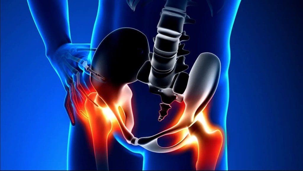 El Paso Care for Hip Injuries: Top Treatment Options