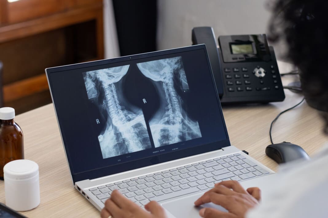 Sciatica Clinic Enhanced Surgical Recovery for Spine Surgery Insights