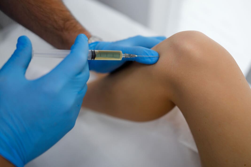 PRP for Knee Meniscus Injuries: Innovative Treatment Approach