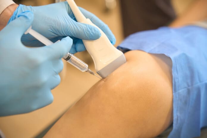 Platelet-Rich Plasma Therapy: Healing Sports Injuries