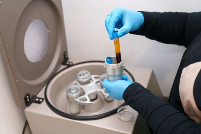 Platelet-Rich Plasma in Musculoskeletal Care Protocols