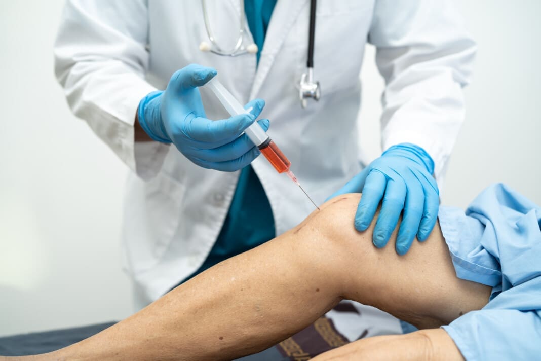 Asian doctor inject Hyaluronic acid platelet rich plasma into th