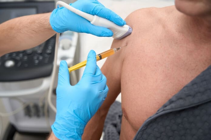 Medical specialist performing biopsy sampling from patient shoulder Integrative Care with Modern Orthobiologic Treatments Explained