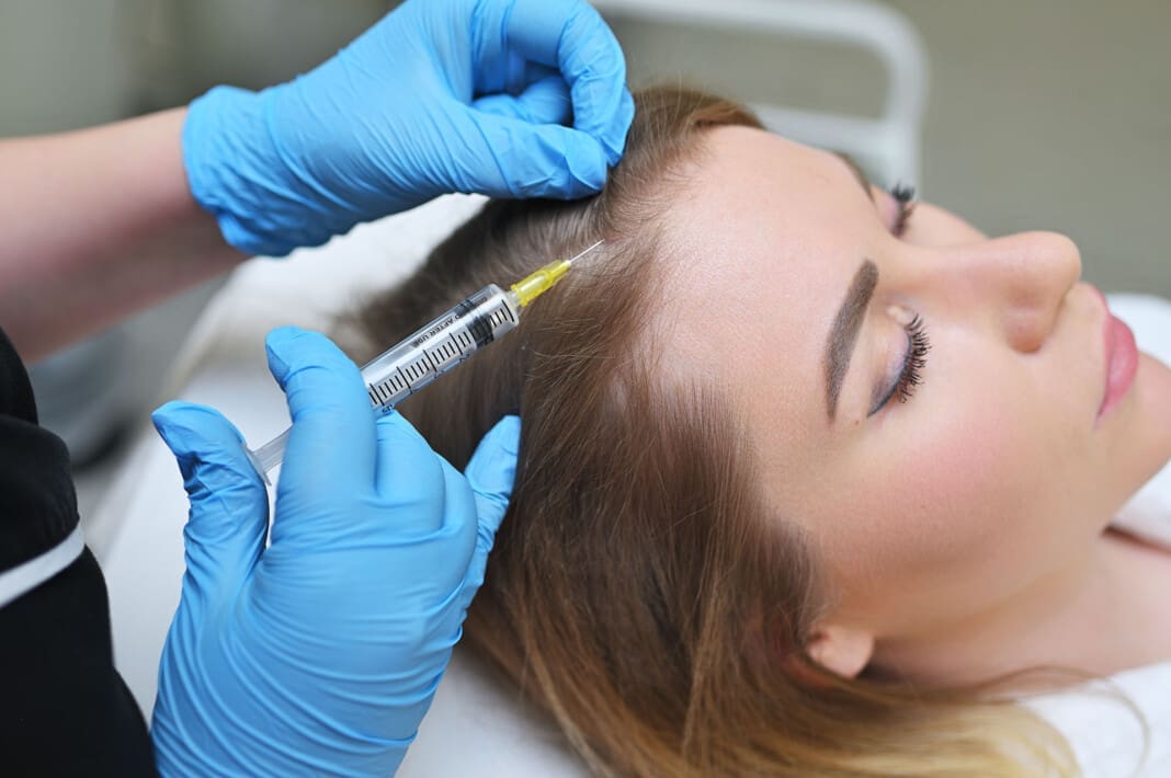 dermatologist cosmetologist performs a mesotherapy procedure and injects an injection into the scalp of a young woman patient. Evidence-Based Hair Loss Solutions and Treatments Explained